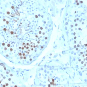 Formalin-fixed, paraffin-embedded human testis stained with KIF2C Mouse Monoclonal Antibody (KIF2C/6520) at 2ug/ml. Inset: PBS instead of primary antibody; secondary only negative control.