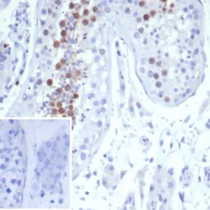 Formalin-fixed, paraffin-embedded human testis stained with KIF2C Mouse Monoclonal Antibody (KIF2C/6522) at 2ug/ml. Inset: PBS instead of primary antibody; secondary only negative control.