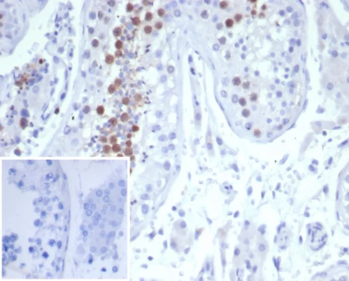Formalin-fixed, paraffin-embedded human testis stained with KIF2C Mouse Monoclonal Antibody (KIF2C/6522) at 2ug/ml. Inset: PBS instead of primary antibody; secondary only negative control. KIF2C (Kinesin Family Member 2C) / MCAK Antibody