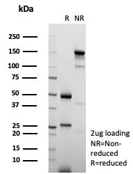 SDS-PAGE Analysis of Purified KIF2C Mouse Monoclonal Antibody (KIF2C/6522). Confirmation of Purity and Integrity of Antibody. KIF2C (Kinesin Family Member 2C) / MCAK Antibody - Image 3