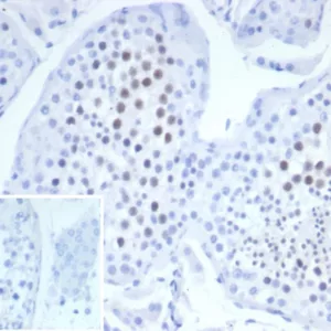 Formalin-fixed, paraffin-embedded human testis stained with KIF2C Mouse Monoclonal Antibody (KIF2C/6523) at 2ug/ml. Inset: PBS instead of primary antibody; secondary only negative control.