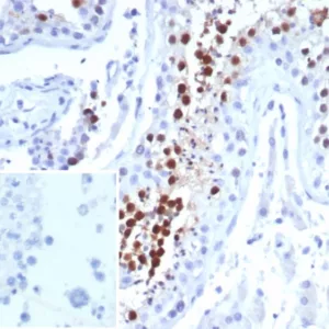 Formalin-fixed, paraffin-embedded human testis stained with KIF2C Mouse Monoclonal Antibody (KIF2C/6524) at 2ug/ml. Inset: PBS instead of primary antibody; secondary only negative control.