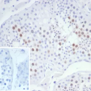 Formalin-fixed, paraffin-embedded human testis stained with KIF2C Mouse Monoclonal Antibody (KIF2C/6526) at 2ug/ml. Inset: PBS instead of primary antibody; secondary only negative control.