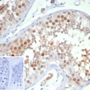 Formalin-fixed, paraffin-embedded human testis stained with KIF2C Mouse Monoclonal Antibody (KIF2C/6528) at 2ug/ml. Inset: PBS instead of primary antibody; secondary only negative control.