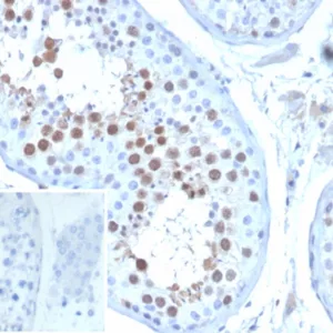 Formalin-fixed, paraffin-embedded human testis stained with KIF2C Mouse Monoclonal Antibody (KIF2C/6529) at 2ug/ml. Inset: PBS instead of primary antibody; secondary only negative control.
