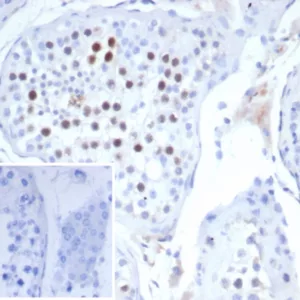 Formalin-fixed, paraffin-embedded human testis stained with KIF2C Mouse Monoclonal Antibody (KIF2C/4702) at 2ug/ml. Inset: PBS instead of primary antibody; secondary only negative control.