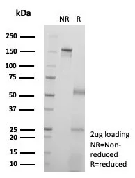 SDS-PAGE Analysis of Purified KIF2C Mouse Monoclonal Antibody (KIF2C/6518). Confirmation of Purity and Integrity of Antibody.