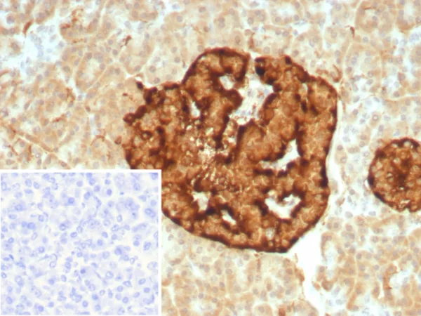 Formalin-fixed, paraffin-embedded human pancreas stained with  Chromogranin A Recombinant Rabbit Monoclonal Antibody (CHGA/8929R). HIER: Tris/EDTA, pH9.0, 45min. 2°C: HRP-polymer, 30min. DAB, 5min.