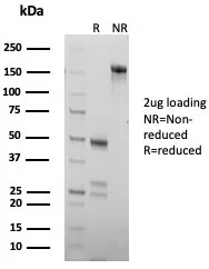 SDS-PAGE Analysis of Purified Chromogranin B Mouse Monoclonal Antibody (CHGB/7756). Confirmation of Purity and Integrity of Antibody.