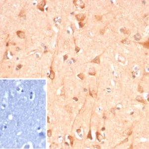 Formalin-fixed, paraffin-embedded human brain stained with ADCY8 Mouse Monoclonal Antibody (ADCY8/7341). Inset: PBS instead of primary antibody; secondary only negative control.