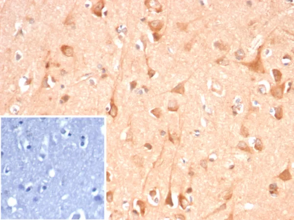 Formalin-fixed, paraffin-embedded human brain stained with ADCY8 Mouse Monoclonal Antibody (ADCY8/7341). Inset: PBS instead of primary antibody; secondary only negative control.
