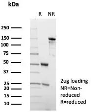 SDS-PAGE Analysis of Purified ADCY8 Mouse Monoclonal Antibody (ADCY8/7573). Confirmation of Purity and Integrity of Antibody.