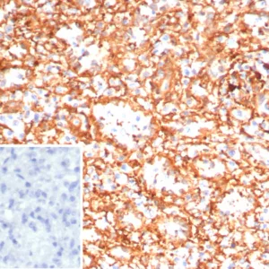 Formalin-fixed, paraffin-embedded human spleen stained with ADCY8 Mouse Monoclonal Antibody (ADCY8/7574). HIER: Tris/EDTA, pH9.0, 45min. 2°C: HRP-polymer, 30min. DAB, 5min.