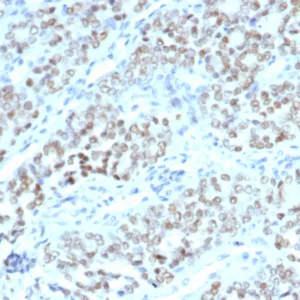 Formalin-fixed, paraffin-embedded human fallopian tube stained with BTBD9 Mouse Monoclonal Antibody (BTBD9/7501). HIER: Tris/EDTA, pH9.0, 45min. 2°C: HRP-polymer, 30min. DAB, 5min.
