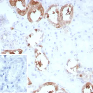 Formalin-fixed, paraffin-embedded human kidney stained with CKBB Recombinant Mouse Monoclonal Antibody (rCKBB/8839). Inset: PBS instead of primary antibody; secondary only negative control.