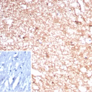 Formalin-fixed, paraffin-embedded human brain stained with CKBB Recombinant Mouse Monoclonal Antibody (rCKBB/8841). Inset: PBS instead of primary antibody; secondary only negative control.