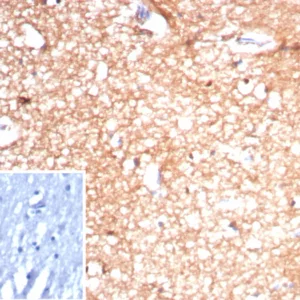 Formalin-fixed, paraffin-embedded human brain stained with CKBB Recombinant Mouse Monoclonal Antibody (rCKBB/8842). Inset: PBS instead of primary antibody; secondary only negative control.
