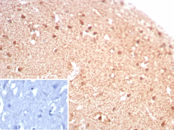 Formalin-fixed, paraffin-embedded human brain stained with CKBB Recombinant Mouse Monoclonal Antibody (rCKBB/8844). Inset: PBS instead of primary antibody; secondary only negative control. Recombinant Creatine Phosphokinase-BB (CK-BB) Antibody