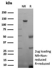 SDS-PAGE Analysis of Purified CKBB Recombinant Mouse Monoclonal Antibody (rCKBB/8844). Confirmation of Purity and Integrity of Antibody. Recombinant Creatine Phosphokinase-BB (CK-BB) Antibody - Image 2