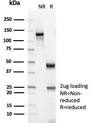 SDS-PAGE Analysis of Purified CKBB Mouse Monoclonal Antibody (CKBB/6566). Confirmation of Purity and Integrity of Antibody.