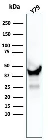 Western blot analysis of Y79 cell lysate using CKBB Mouse Monoclonal Antibody (CKBB/6567).
