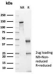 SDS-PAGE Analysis of Purified CKBB Mouse Monoclonal Antibody (CKBB/6568). Confirmation of Purity and Integrity of Antibody.