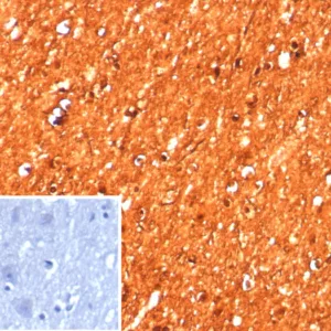 Formalin-fixed, paraffin-embedded human brain stained with CKBB Recombinant Rabbit Monoclonal Antibody (CKBB/8608R). Inset: PBS instead of primary antibody; secondary only negative control.