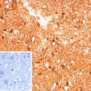 Formalin-fixed, paraffin-embedded human brain stained with CKBB Recombinant Rabbit Monoclonal Antibody (CKBB/8609R). Inset: PBS instead of primary antibody; secondary only negative control.