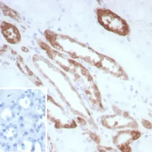 Formalin-fixed, paraffin-embedded human kidney stained with CKBB Recombinant Rabbit Monoclonal Antibody (CKBB/8840R). Inset: PBS instead of primary antibody; secondary only negative control.