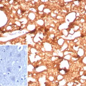 Formalin-fixed, paraffin-embedded human brain stained with CKBB Recombinant Rabbit Monoclonal Antibody (CKBB/8843R). Inset: PBS instead of primary antibody; secondary only negative control.