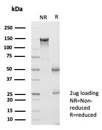 SDS-PAGE Analysis of Purified BATF2 Mouse Monoclonal Antibody (PCRP-BATF2-2B9). Confirmation of Purity and Integrity of Antibody.