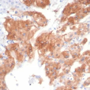 Formalin-fixed, paraffin-embedded human adrenal gland stained with IL22RA2 Mouse Monoclonal Antibody (IL22RA2/7291). HIER: Tris/EDTA, pH9.0, 45min. 2°C: HRP-polymer, 30min. DAB, 5min.