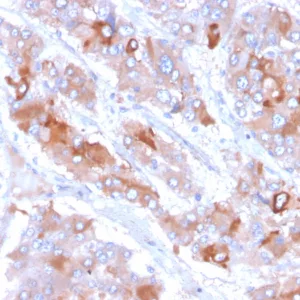 Formalin-fixed, paraffin-embedded human adrenal gland stained with  Clusterin / APOJ Mouse Monoclonal Antibody (CLU/6692). HIER: Tris/EDTA, pH9.0, 45min. 2°C: HRP-polymer, 30min. DAB, 5min.