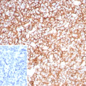 Formalin-fixed, paraffin-embedded human tonsil stained with Clusterin / APOJ Recombinant Rabbit Monoclonal Antibody (CLU/8865R). Inset: PBS instead of primary antibody; secondary only negative control.