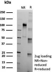SDS-PAGE Analysis of Purified Clusterin Recombinant Rabbit Monoclonal Antibody (CLU/9192R). Confirmation of Purity and Integrity of Antibody.