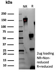 SDS-PAGE Analysis of Purified Adipophilin Recombinant Mouse Monoclonal Antibody (rADFP/9321). Confirmation of Integrity and Purity of Antibody.