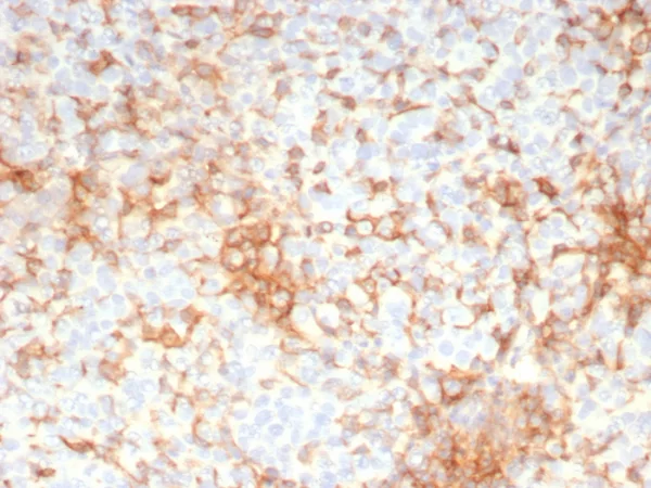 Formalin-fixed, paraffin-embedded human adrenal gland stained with Adipophilin Recombinant Mouse Monoclonal Antibody (rADFP/9321). HIER: Tris/EDTA, pH9.0, 45min. 2°C: HRP-polymer, 30min. DAB, 5min.