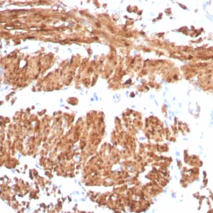 Formalin-fixed, paraffin-embedded human smooth muscle stained with Calponin Rabbit Recombinant Monoclonal Antibody (CNN1/8870R). HIER: Tris/EDTA, pH9.0, 45min. 2°C: HRP-polymer, 30min. DAB, 5min.
