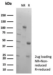 SDS-PAGE Analysis of Purified COL2A Recombinant Rabbit Monoclonal Antibody (COL2A1/8810R). Confirmation of Purity and Integrity of Antibody.