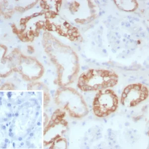 Formalin-fixed, paraffin-embedded human kidney stained with COL2A Recombinant Rabbit Monoclonal Antibody (COL2A1/8882R). Inset: PBS instead of primary antibody; secondary only negative control.