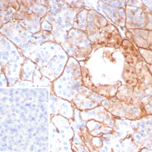 Formalin-fixed, paraffin-embedded human pancreas stained with COL4A5 Recombinant Rabbit Monoclonal Antibody (COL4A5/9396R). Inset: PBS instead of primary antibody; secondary only negative control.