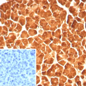 Formalin-fixed, paraffin-embedded human pancreas stained with CPA1 Recombinant Mouse Monoclonal Antibody (rCPA1/8688). Inset: PBS instead of primary antibody; secondary only negative control.