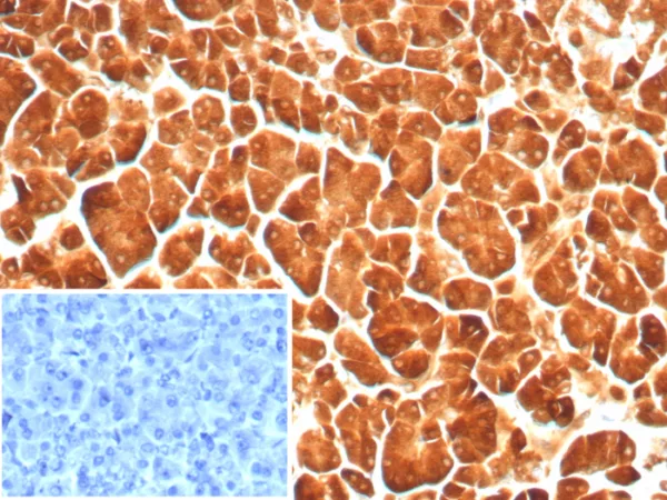 Formalin-fixed, paraffin-embedded human pancreas stained with CPA1 Recombinant Mouse Monoclonal Antibody (rCPA1/8689). Inset: PBS instead of primary antibody; secondary only negative control.