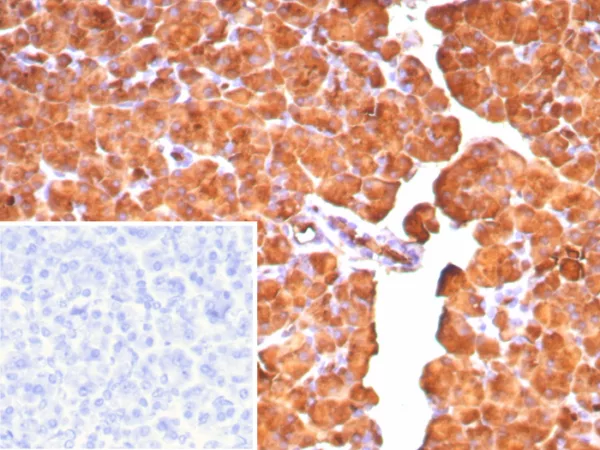 Formalin-fixed, paraffin-embedded human pancreas stained with Carboxypeptidase A1 / CPA1 Mouse Monoclonal Antibody (CPA1/8777). Inset: PBS instead of primary antibody; secondary only negative control.