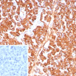 Formalin-fixed, paraffin-embedded human pancreas stained with Carboxypeptidase A1 / CPA1 Mouse Monoclonal Antibody (CPA1/8784). Inset: PBS instead of primary antibody; secondary only negative control.