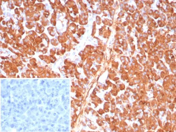 Formalin-fixed, paraffin-embedded human pancreas stained with Carboxypeptidase A1 / CPA1 Mouse Monoclonal Antibody (CPA1/8784). Inset: PBS instead of primary antibody; secondary only negative control.