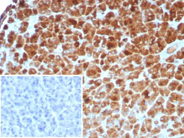 Formalin-fixed, paraffin-embedded human pancreas stained with CPA1 Recombinant Mouse Monoclonal Antibody (rCPA1/8518). Inset: PBS instead of primary antibody; secondary only negative control.