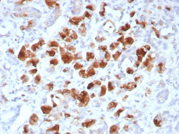 Formalin-fixed, paraffin-embedded human pancreas stained with CPA1 Recombinant Mouse Monoclonal Antibody (rCPA1/8518). HIER: Tris/EDTA, pH9.0, 45min. 2°C: HRP-polymer, 30min. DAB, 5min.