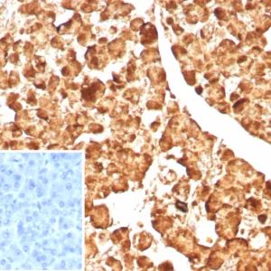 Formalin-fixed, paraffin-embedded human pancreas stained with CPA1 Recombinant Rabbit Monoclonal Antibody (CPA1/8623R). Inset: PBS instead of primary antibody; secondary only negative control.