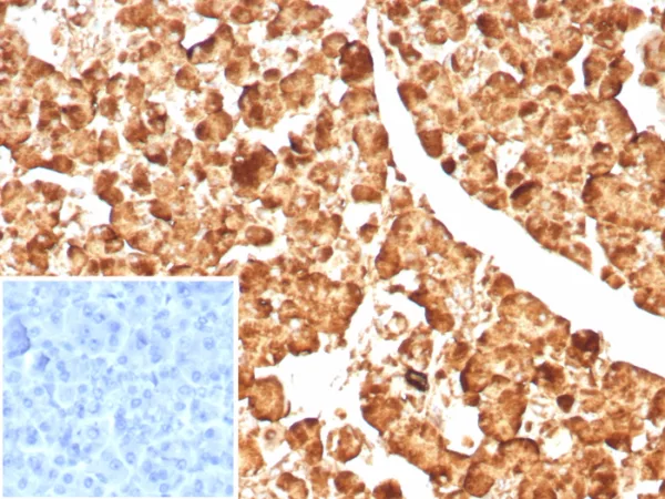 Formalin-fixed, paraffin-embedded human pancreas stained with CPA1 Recombinant Rabbit Monoclonal Antibody (CPA1/8623R). Inset: PBS instead of primary antibody; secondary only negative control.